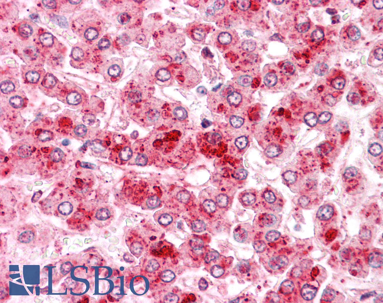 COMT Antibody - Anti-COMT antibody IHC of human liver. Immunohistochemistry of formalin-fixed, paraffin-embedded tissue after heat-induced antigen retrieval.