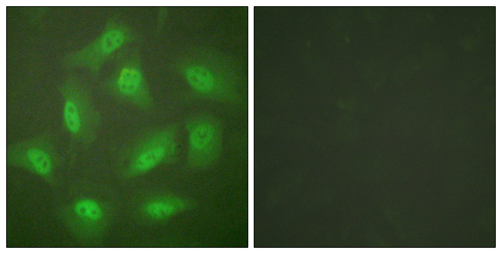 COPS3 / CSN3 Antibody - Immunofluorescence analysis of HeLa cells, using JAB1 Antibody. The picture on the right is blocked with the synthesized peptide.