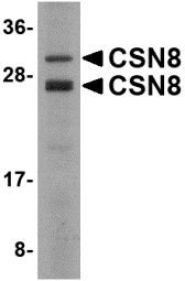 COPS8 / COP9 Antibody - Western blot of COPS8 in Human liver lysate with COPS8 antibody at 2 ug/ml.