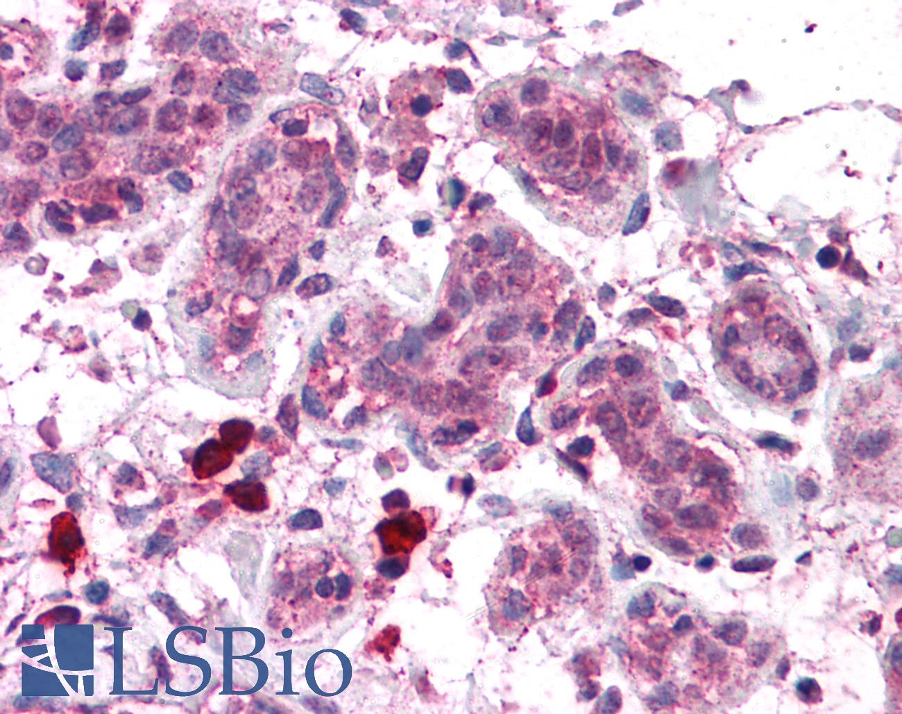 COPS8 / COP9 Antibody - Anti-COPS8 antibody IHC of human breast. Immunohistochemistry of formalin-fixed, paraffin-embedded tissue after heat-induced antigen retrieval. Antibody concentration 5 ug/ml.