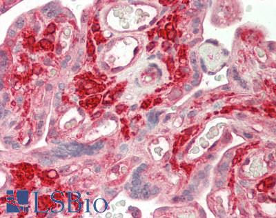 CORO1B Antibody - Human Placenta: Formalin-Fixed, Paraffin-Embedded (FFPE)