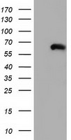 CORO1B Antibody - HEK293T cells were transfected with the pCMV6-ENTRY control (Left lane) or pCMV6-ENTRY CORO1B (Right lane) cDNA for 48 hrs and lysed. Equivalent amounts of cell lysates (5 ug per lane) were separated by SDS-PAGE and immunoblotted with anti-CORO1B.