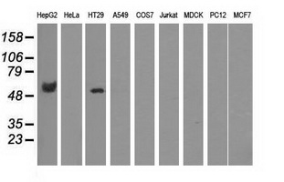 CORO1B Antibody - Western blot of extracts (35 ug) from 9 different cell lines by using anti-CORO1B monoclonal antibody.