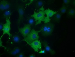 CORO1B Antibody - Anti-CORO1B mouse monoclonal antibody  immunofluorescent staining of COS7 cells transiently transfected by pCMV6-ENTRY CORO1B.