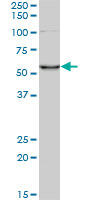 CORO1C Antibody - Western blot of CORO1C expression in HeLa NE.