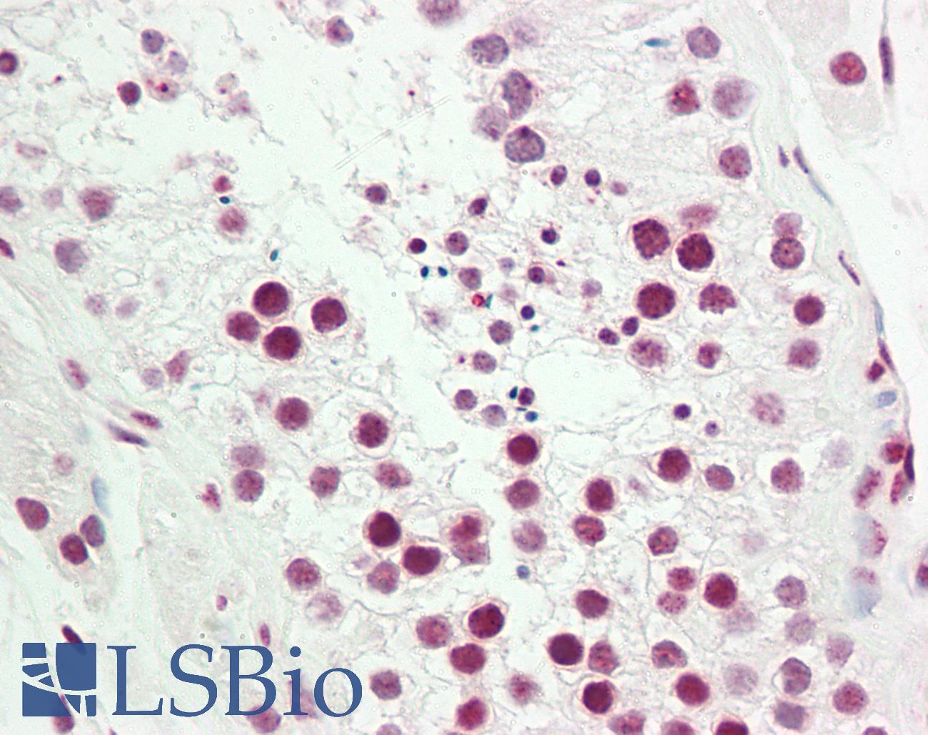 COUP-TFII / NR2F2 Antibody - Anti-COUP-TFII / NR2F2 antibody IHC staining of human testis. Immunohistochemistry of formalin-fixed, paraffin-embedded tissue after heat-induced antigen retrieval. Antibody dilution 1:50.