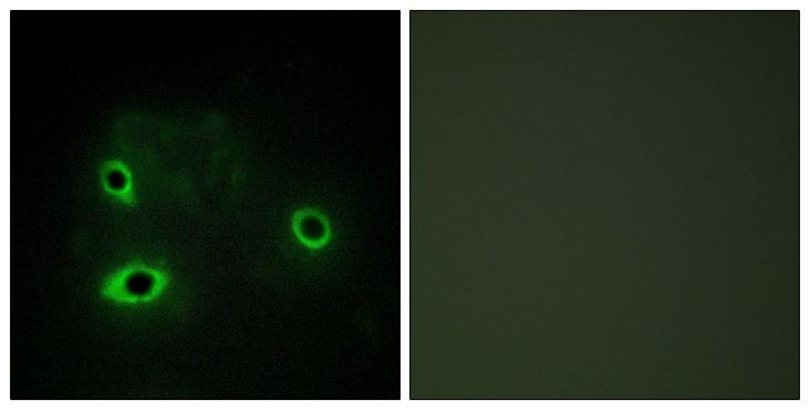 COX4I2 Antibody - Immunofluorescence analysis of COS7 cells, using COX42 Antibody. The picture on the right is blocked with the synthesized peptide.
