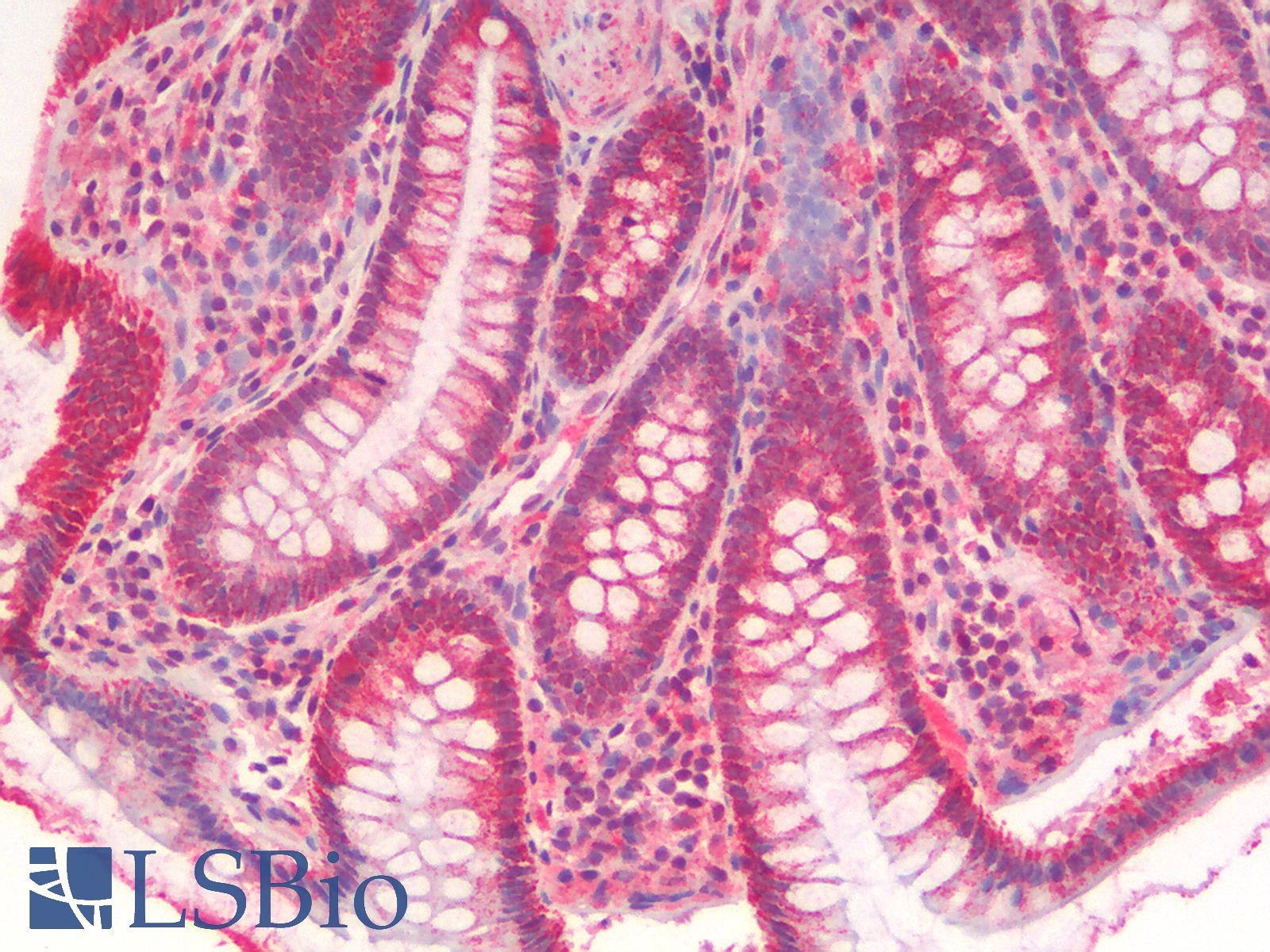 COX5B Antibody - Human Colon: Formalin-Fixed, Paraffin-Embedded (FFPE)