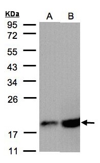 COXIV / COX4 Antibody - Sample (30 ug of whole cell lysate). A: A431, B: MOLT4. 12% SDS PAGE. COXIV / COX4 antibody diluted at 1:2000