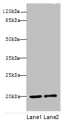 COXIV / COX4 Antibody - Western blot All lanes: COX4I1 antibody at 10ug/ml Lane 1 : Rats muscle tissue Lane 2 : Zebrafish lysate Secondary Goat polyclonal to Rabbit IgG at 1/10000 dilution Predicted band size: 20 kDa Observed band size: 20,85 kDa