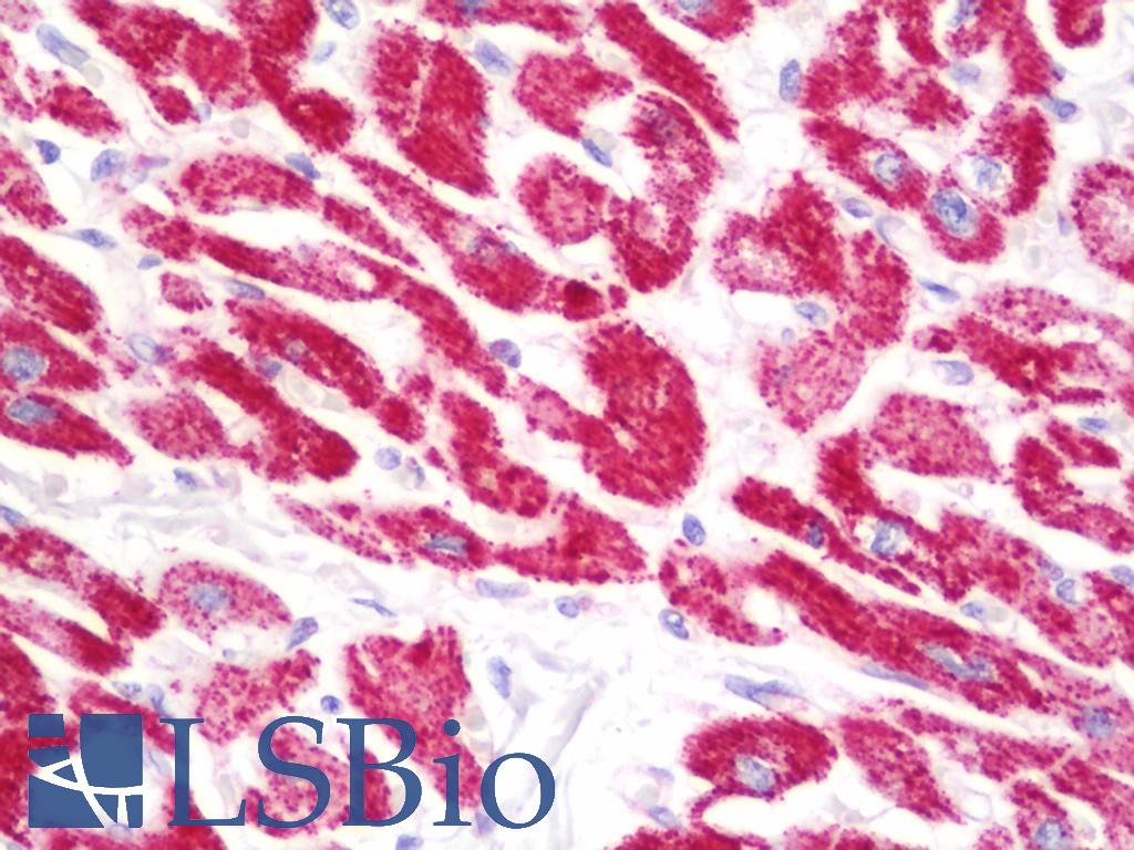 COXIV / COX4 Antibody - Anti-COXIV / COX4 antibody IHC staining of human heart. Immunohistochemistry of formalin-fixed, paraffin-embedded tissue after heat-induced antigen retrieval. Antibody dilution 1:100.