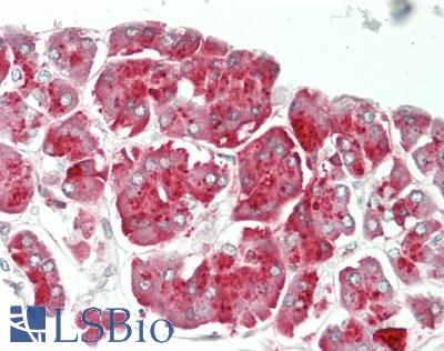 CPA1 / Carboxypeptidase A Antibody - Human Pancreas: Formalin-Fixed, Paraffin-Embedded (FFPE)