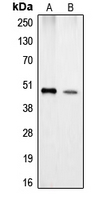 CPA1 / Carboxypeptidase A Antibody - Western blot analysis of Carboxypeptidase A1 expression in Jurkat (A); HeLa (B) whole cell lysates.