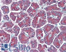 CPB / Carboxypeptidase B Antibody - Human Pancreas: Formalin-Fixed, Paraffin-Embedded (FFPE)