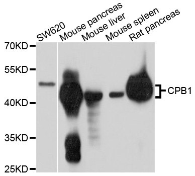 CPB / Carboxypeptidase B Antibody - Western blot analysis of extracts of various cell lines, using CPB1 antibody at 1:1000 dilution. The secondary antibody used was an HRP Goat Anti-Rabbit IgG (H+L) at 1:10000 dilution. Lysates were loaded 25ug per lane and 3% nonfat dry milk in TBST was used for blocking. An ECL Kit was used for detection and the exposure time was 5s.