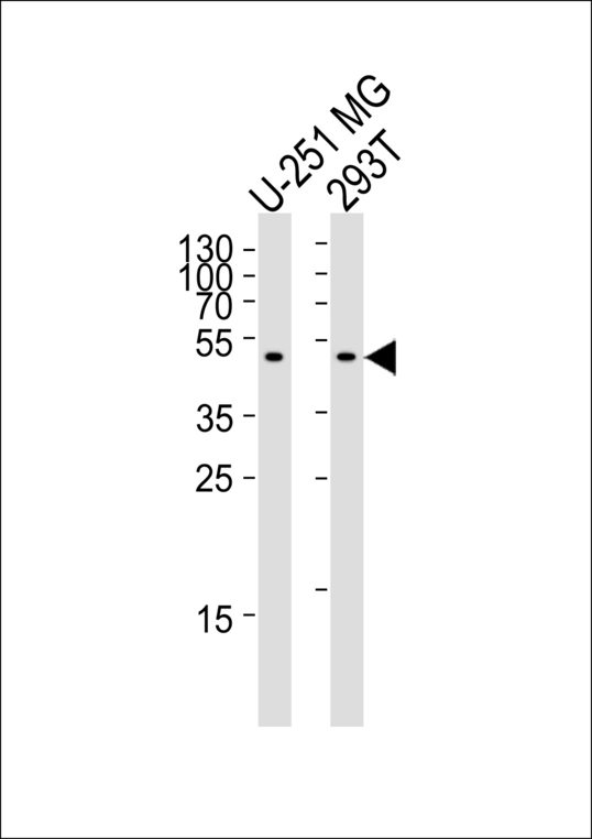 CPM / Carboxypeptidase M Antibody - Western blot of lysates from U-251 MG, 293T cell line (from left to right), using CPM Antibody. Antibody was diluted at 1:1000 at each lane. A goat anti-rabbit IgG H&L (HRP) at 1:5000 dilution was used as the secondary antibody. Lysates at 35ug per lane.