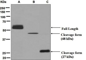 CPN1 Antibody - Western blot analysis on (A) human plasma, (B) HepG2, and (C) fetal liver lysates using anti-CPN1 antibody.