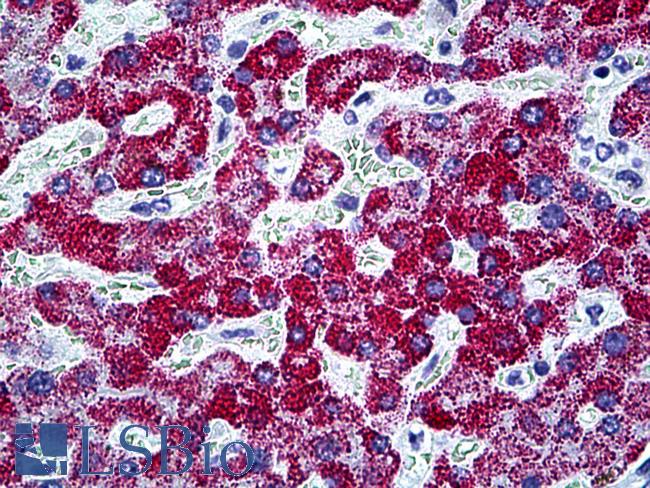 CPS1 Antibody - Anti-CPS1 antibody IHC of human liver. Immunohistochemistry of formalin-fixed, paraffin-embedded tissue after heat-induced antigen retrieval. Antibody concentration 5 ug/ml.