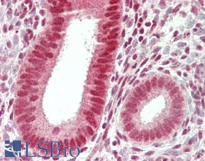 CPSF6 Antibody - Human Uterus: Formalin-Fixed, Paraffin-Embedded (FFPE)