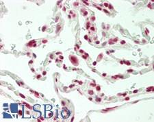 CPSF6 Antibody - Human Lung: Formalin-Fixed, Paraffin-Embedded (FFPE)