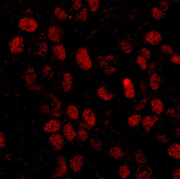 CPSF6 Antibody - Detection of Human CPSF68 by Immunofluorescence. Sample: FFPE section of human colon carcinoma. Antibody: Affinity purified rabbit anti-CPSF68 used at a dilution of 1:100. Detection: Red-fluorescent goat anti-rabbit IgG highly cross-adsorbed Antibody used at a dilution of 1:100.