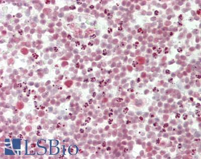 CPSF6 Antibody - Human Colon, Lymphoid Aggregate: Formalin-Fixed, Paraffin-Embedded (FFPE)