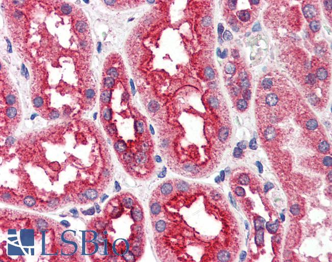 CPT1A Antibody - Anti-CPT1A antibody IHC of human kidney. Immunohistochemistry of formalin-fixed, paraffin-embedded tissue after heat-induced antigen retrieval. Antibody concentration 4 ug/ml.