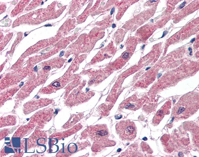 CPT1B Antibody - Anti-CPT1B antibody IHC of human heart. Immunohistochemistry of formalin-fixed, paraffin-embedded tissue after heat-induced antigen retrieval. Antibody concentration 75 ug/ml.