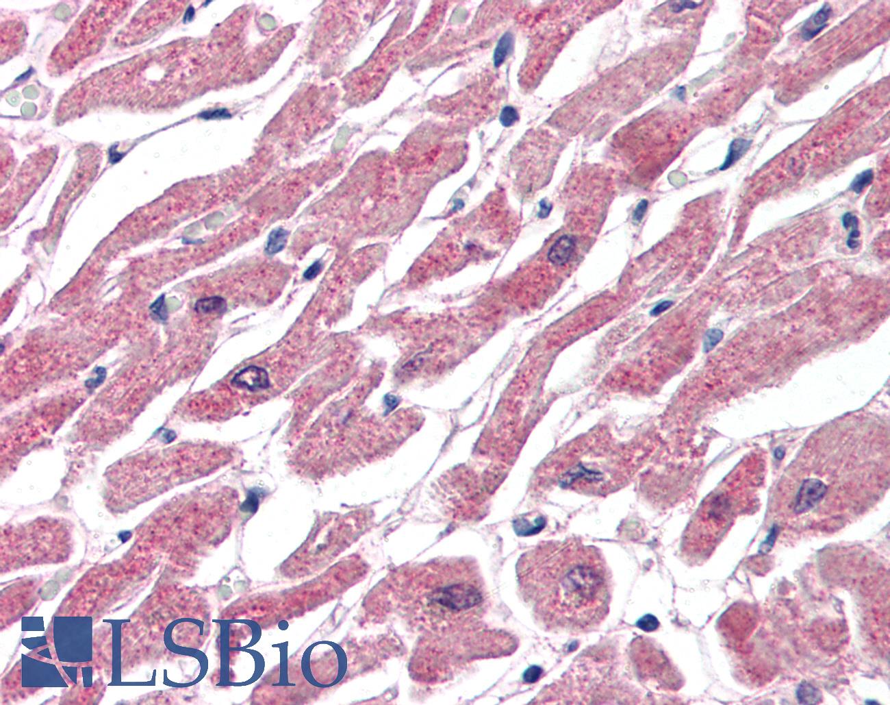 CPT1B Antibody - Anti-CPT1B antibody IHC of human heart. Immunohistochemistry of formalin-fixed, paraffin-embedded tissue after heat-induced antigen retrieval. Antibody concentration 75 ug/ml.