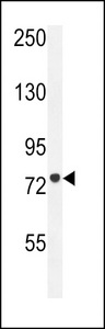 CPT1C Antibody - CPT1C Antibody western blot of HL-60 cell line lysates (35 ug/lane). The CPT1C antibody detected the CPT1C protein (arrow).