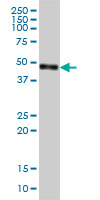 CPVL Antibody - CPVL monoclonal antibody, clone 2G5-1C1 Western blot of CPVL expression in Jurkat.
