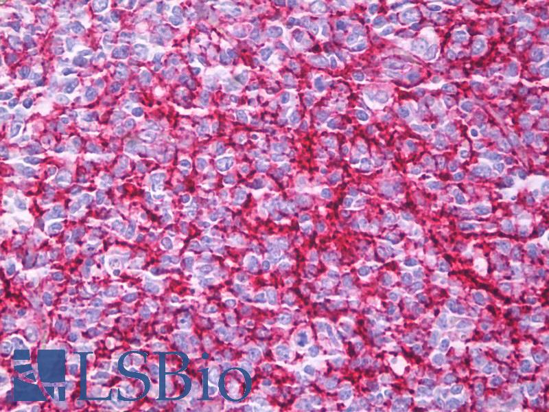 CR1 / CD35 Antibody - Anti-CD35 antibody IHC of human tonsil, germinal center. Immunohistochemistry of formalin-fixed, paraffin-embedded tissue after heat-induced antigen retrieval. Antibody concentration 10 ug/ml.  This image was taken for the unmodified form of this product. Other forms have not been tested.