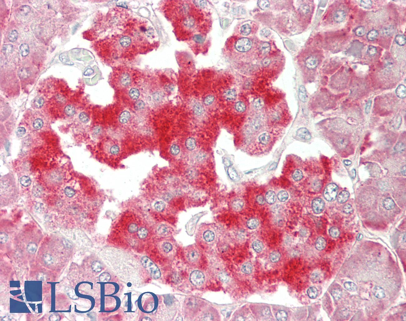 CR6 / GADD45G Antibody - Human Pancreas: Formalin-Fixed, Paraffin-Embedded (FFPE)