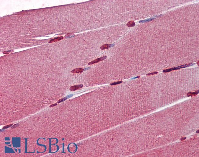CRABP1 / CRABP Antibody - Anti-CRABP1 antibody IHC of human skeletal muscle. Immunohistochemistry of formalin-fixed, paraffin-embedded tissue after heat-induced antigen retrieval. Antibody concentration 5 ug/ml.
