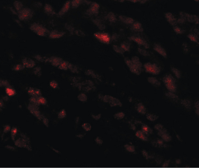 CRACR2A / EFCAB4B Antibody - Immunofluorescence of EFCAB4B in human kidney tissue with EFCAB4B antibody at 20 ug/ml.