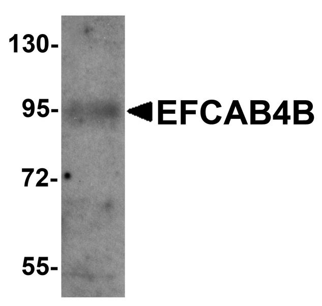CRACR2A / EFCAB4B Antibody - Western blot analysis of EFCAB4B in mouse kidney tissue lysate with EFCAB4B antibody at 1 ug/ml.