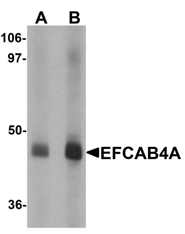 CRACR2B / EFCAB4A Antibody - Western blot analysis of EFCAB4A in human lung tissue lysate with EFCAB4A antibody at (A) 1 and (B) 2 ug/ml.