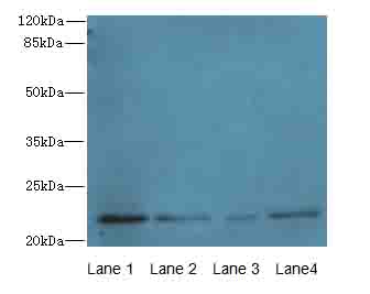 CRADD / RAIDD Antibody - Western blot analysis using CRADD antibody. Lane1: Hela whole cell lysate. Lane2: K562 whole cell lysate. Lane3: MCF7 whole cell lysate. Lane4: A431 whole cell lysate.  This image was taken for the unconjugated form of this product. Other forms have not been tested.