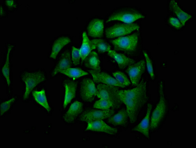CRADD / RAIDD Antibody - Immunofluorescence staining of A549 cells with CRADD Antibody at 1:530, counter-stained with DAPI. The cells were fixed in 4% formaldehyde, permeabilized using 0.2% Triton X-100 and blocked in 10% normal Goat Serum. The cells were then incubated with the antibody overnight at 4°C. The secondary antibody was Alexa Fluor 488-congugated AffiniPure Goat Anti-Rabbit IgG(H+L).