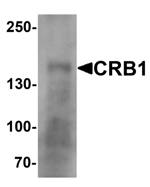 CRB1 Antibody - Western blot analysis of CRB1 in human small intestine Tissue lysate with CRB1 antibody at 1 ug/ml.