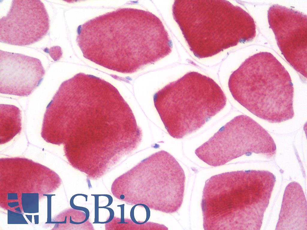 CRB1 Antibody - Anti-CRB1 antibody IHC staining of human skeletal muscle. Immunohistochemistry of formalin-fixed, paraffin-embedded tissue after heat-induced antigen retrieval. Antibody concentration 10 ug/ml.
