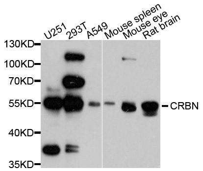 CRBN / Cereblon Antibody - Western blot analysis using CRBN antibody.