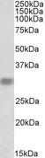 CRD / CRX Antibody - CRX antibody (1 ug/ml) staining of Rat Retina lysate (35 ug protein in RIPA buffer). Primary incubation was 1 hour. Detected by chemiluminescence.