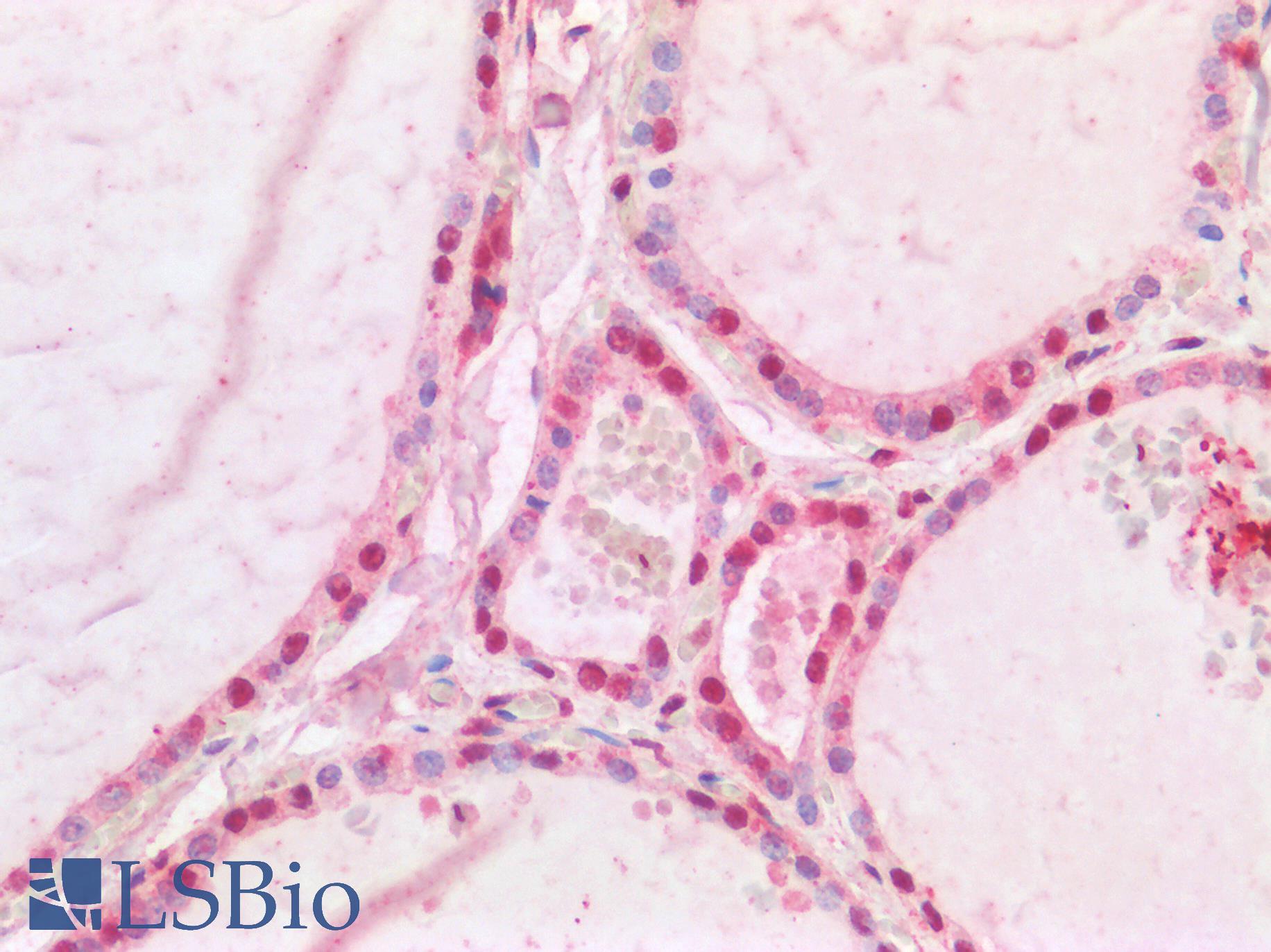 CREB1 / CREB Antibody - Human Thyroid: Formalin-Fixed, Paraffin-Embedded (FFPE)
