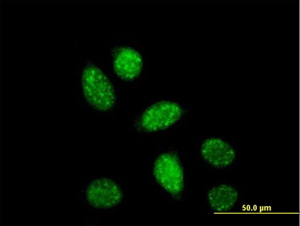 CREB1 / CREB Antibody - Immunofluorescence of monoclonal antibody to CREB1 on HeLa cell. [antibody concentration 10 ug/ml].
