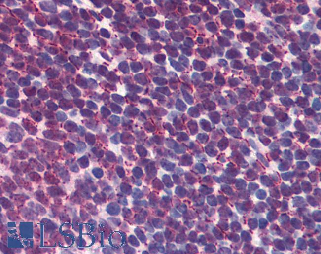 CREB1 / CREB Antibody - Anti-CREB1 / CREB antibody IHC of human tonsil. Immunohistochemistry of formalin-fixed, paraffin-embedded tissue after heat-induced antigen retrieval. Antibody concentration 5 ug/ml.