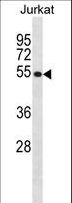 CREB3 / LZIP Antibody - CREB3 Antibody western blot of Jurkat cell line lysates (35 ug/lane). The CREB3 antibody detected the CREB3 protein (arrow).