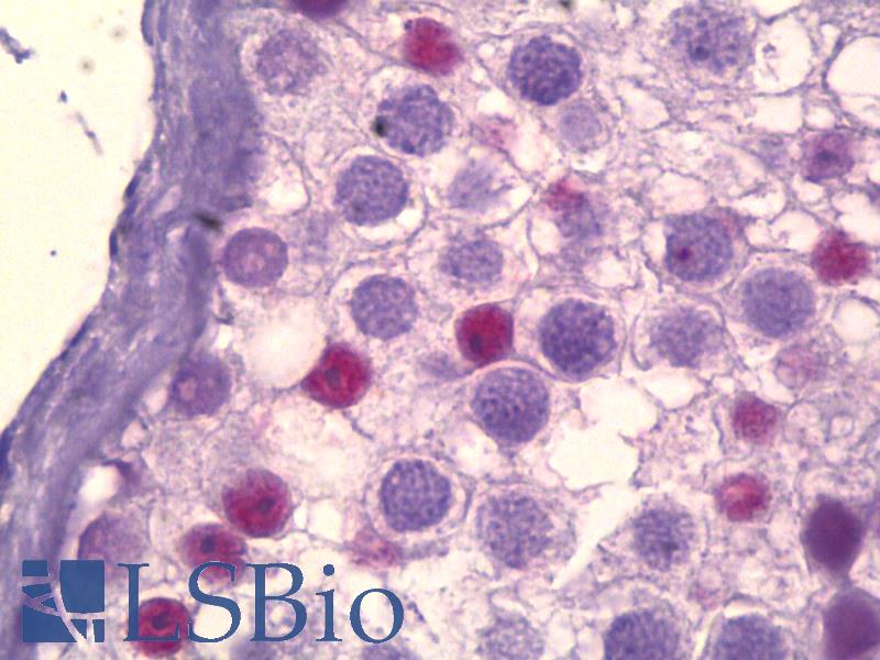 CREBBP / CREB Binding Protein Antibody - Anti-CREBBP antibody IHC of human testis. Immunohistochemistry of formalin-fixed, paraffin-embedded tissue after heat-induced antigen retrieval. Antibody dilution 1:25.