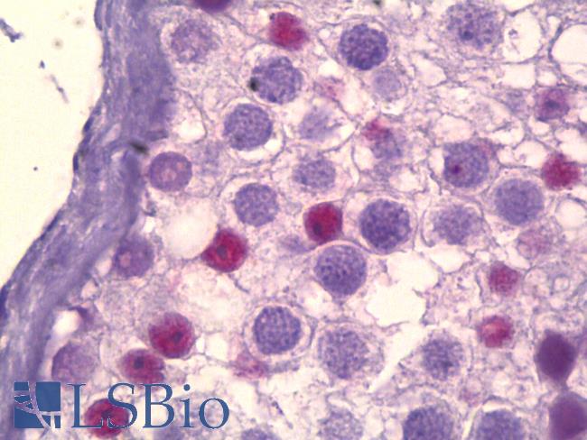 CREBBP / CREB Binding Protein Antibody - Anti-CREBBP antibody IHC of human testis. Immunohistochemistry of formalin-fixed, paraffin-embedded tissue after heat-induced antigen retrieval. Antibody dilution 1:25.