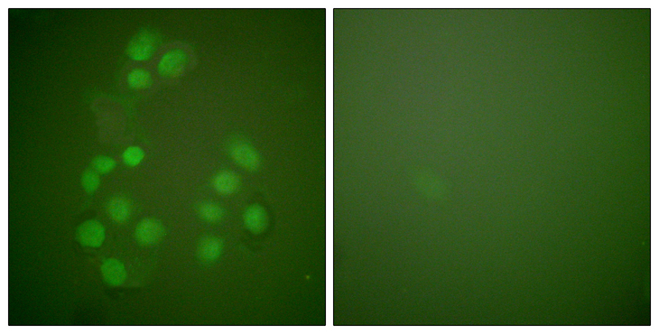 CREBBP / CREB Binding Protein Antibody - Immunofluorescence analysis of A549 cells, using CREB-BP Antibody. The picture on the right is blocked with the synthesized peptide.